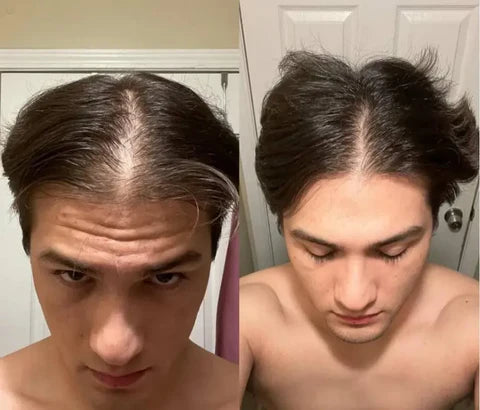 ACEITE PROFESIONAL ANTICAÍDA Y CRECIMIE